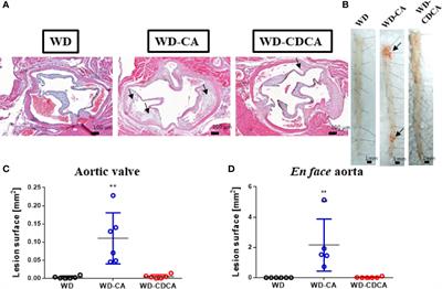 Downregulation of Cyp7a1 by Cholic Acid and Chenodeoxycholic Acid in Cyp27a1/ApoE Double Knockout Mice: Differential Cardiovascular Outcome